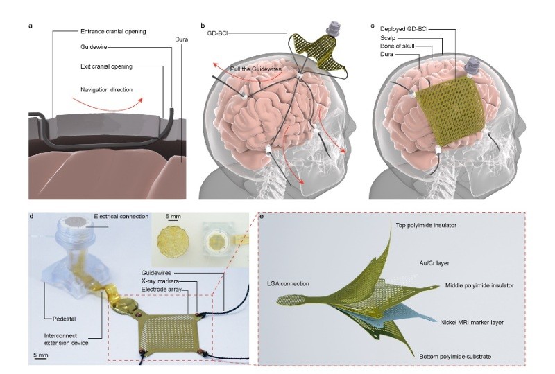 초박막 고밀도 전극 배열을 가이드와이어로 전개하는 최소 침습 수술. 뇌-컴퓨터 인터페이스 기술의 획기적인 발전이다 | image© https://arxiv.org/abs/2511.12907